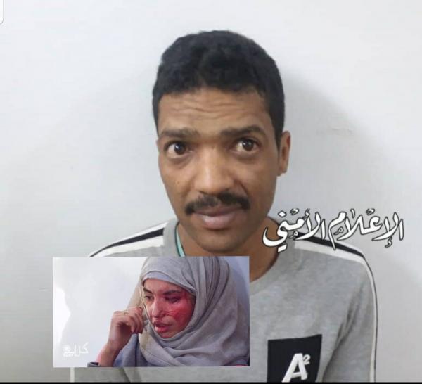 الإعلام الأمني في صنعاء يكشف حقيقة ضبط المتهم بإحراق زوجته "العنود" بمادة الأسيد 